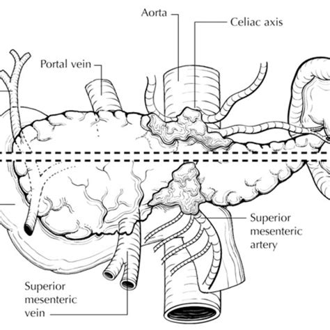 Regional Lymph Nodes Of The Pancreas Anterior View From Greene Et
