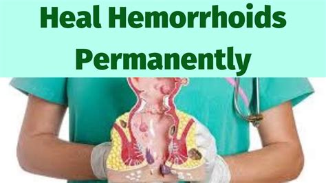 what are hemorrhoids causes symptoms and treatment youtube