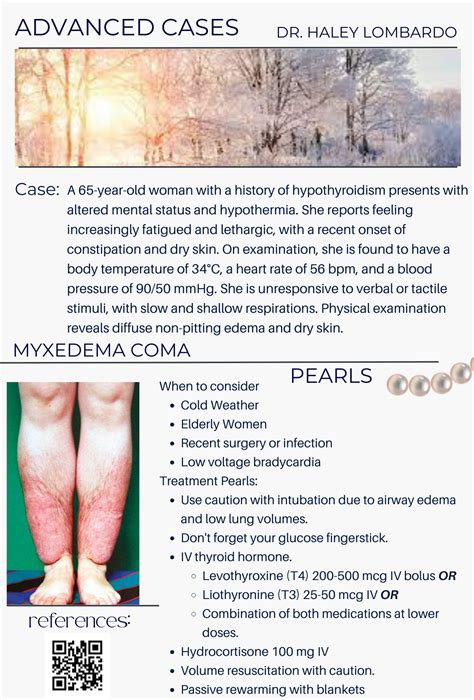 Myxedema Coma By Dr Haley Lombardo Pgy 2