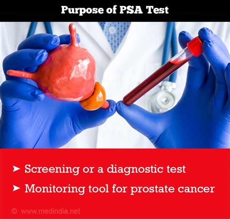 When Is PSA Test Done Screening For Prostate Cancer
