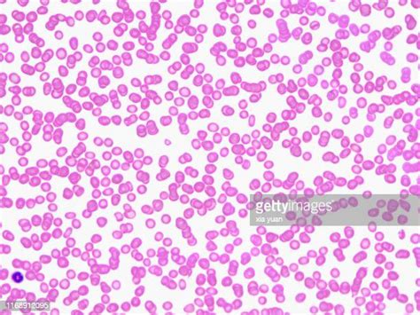 Blood Smear Micrograph Fotografias E Filmes Do Acervo Getty Images