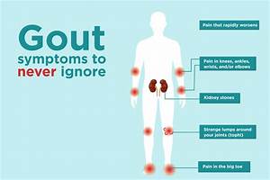 Gout Symptoms You Might Be Ignoring – CreakyJoints Gout  