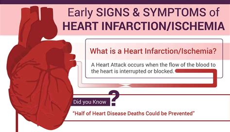 Early Signs And Symptoms Of Heart Disease