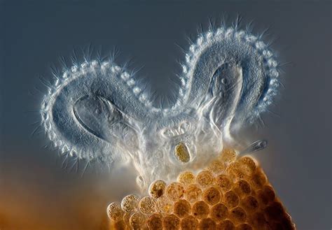 Extraordinary Microscope Photographs The Big Picture