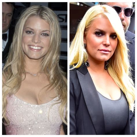 Has Jessica Simpson Had Plastic Surgery Experts Comment On Her Look