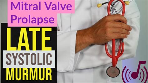 Mitral Valve Prolapse Mvp 🩺 Late Systolic Murmur Sound