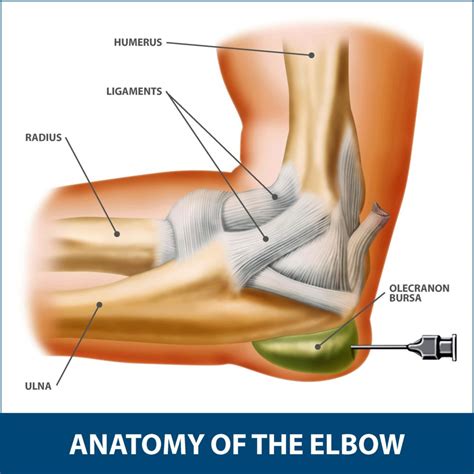 Elbow Bursitis Information Florida Orthopaedic Institute