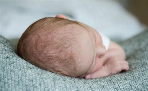Flat Head Syndrome In Babies Causes And Treatment My Babys