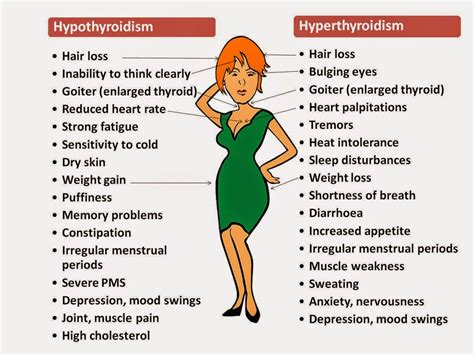 Hyperthyroidism လည္ပင္းၾကီးေရာဂါ