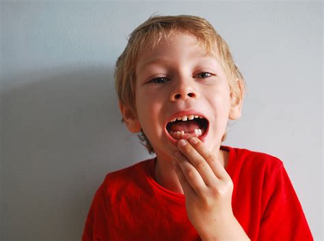 Should You Worry About A Possible Cavity On A Kids Baby Teeth