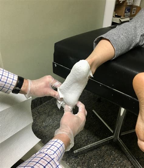 custom foot orthotics ortho kinetics inc orthotics and prosthetics
