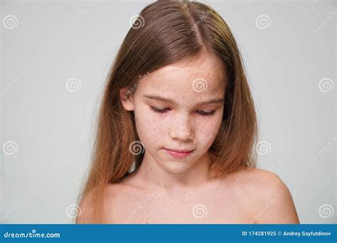 Adolescente Chica Con Pecas Pelo Rojo Cubre La Cara De La Mano Imagen