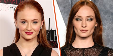 This Is Sophie Turner After Buccal Fat Removal Rpaymoneywubby