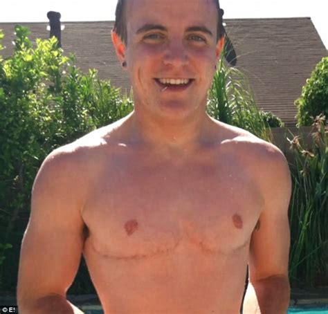 Transgender Man Proudly Reveals His New Pecs After Undergoing Surgery