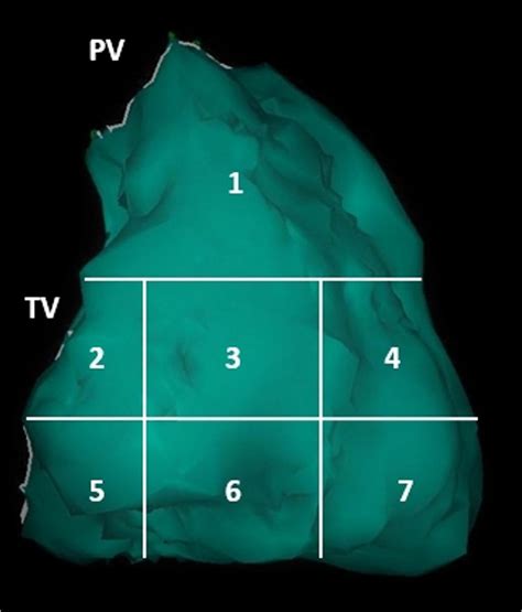Schematic Right Anterior Oblique View Of The Right Ventricle Divided