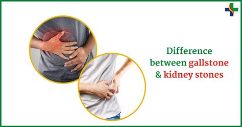 Whats The Difference Between Kidney Stones And Gallstones