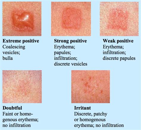 Pin On Healing Wounds