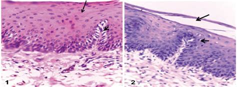 The Hard Palate Showe Keratinized Epithelial Layer Long Arrow Lamina