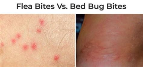 They also tend to appear in different parts of the body and to cluster in different like bed bugs, fleas don't typically spread disease to those they bite. Flea Bites Vs Bed Bug Bites, How to Get Rid of Flea Bites?