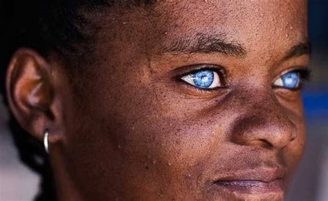 Black Africans With Blue Eyes Separating Myths From Facts Talkafricana
