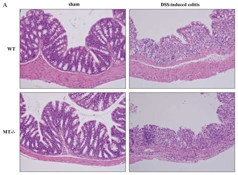 Colon Vs Small Intestine Histology Thoc1 Gene Deletion Affects The