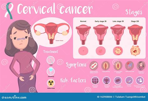 Cervical Cancer Infographic Design Cartoon Vector