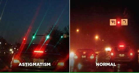 Heres Why This Post On How People With Astigmatism See Light Has Gone