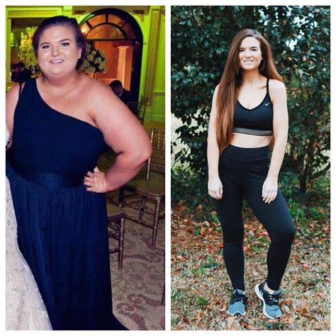 Pin Auf Before And After Weight Loss