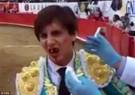 Andres Roca Reys Loses Front Teeth When Bull Shoves Horn Into His Mouth In Mexico Daily Mail