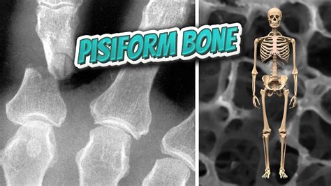 Pisiform Bone 🦴 Everything Human Anatomy Bones 🦴 Youtube
