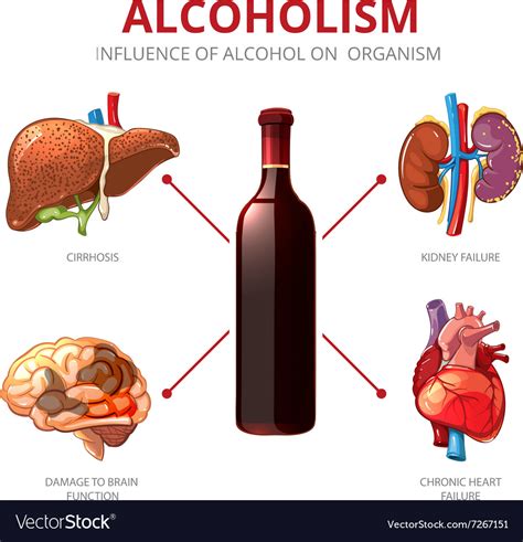 Long Term Effects Alcohol Alcoholism Royalty Free Vector