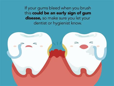 Dental Tips Bleeding Gums Dental Fun Dental Fun Facts Dental Posters
