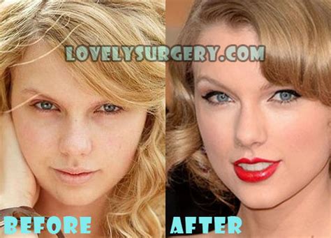 Taylor Swift Plastic Surgery Tell Us What Do You Think About Taylor