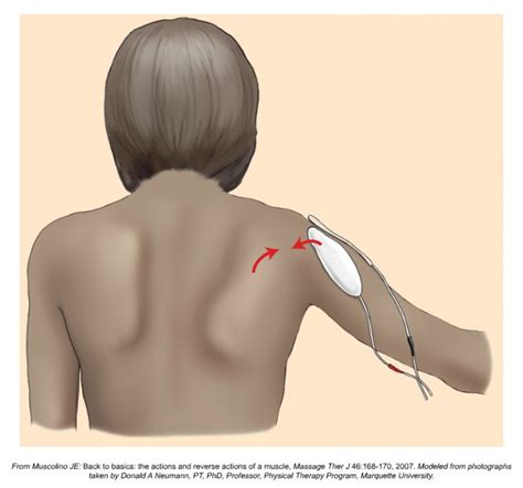 Scapular Dyskinesis Increases The Risk Of Future Shoulder Pain