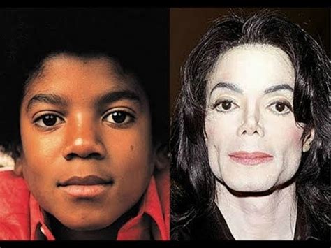 Rinoplastia Do Michael Jackson Michael Jackson Nosejob YouTube
