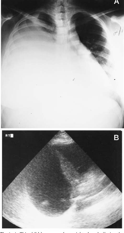 Figure 1 From Implications Of Early Sonographic Evaluation Of
