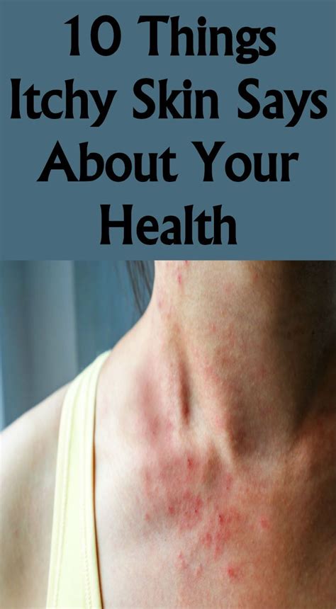 10 Things Itchy Skin Says About Your Health With Images Itchy Skin