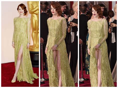 Oscars 2015 Emma Stone Faces A Wardrobe Malfunction