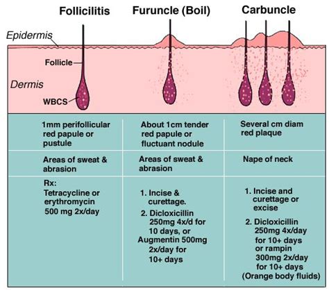Folliculitis Causes Pictures And Treatment