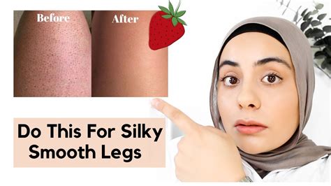 How To Get Rid Of Strawberry Legs At Home Fast