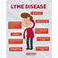Lyme Disease Symptoms Tests Treatment And Prevention