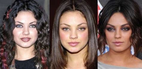 Mila Kunis Plastic Surgery Before And After Pictures 2024