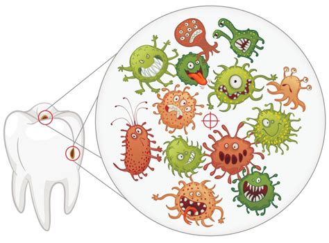 Bacteria In The Mouth Algodones Dentists Guide