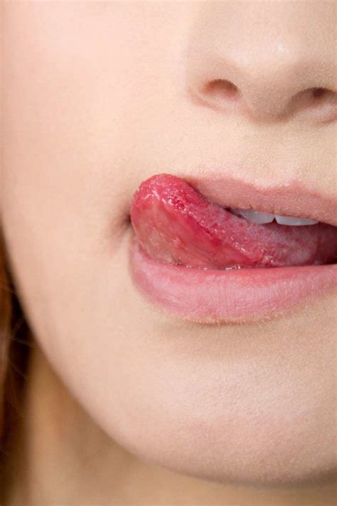 Bitter Taste In Mouth Symptoms Causes And Home Remedies