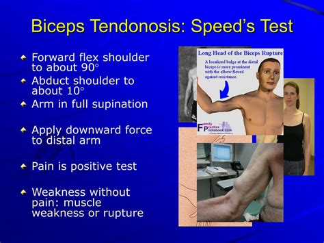 Ppt History And Physical Examination Of The Shoulder Powerpoint