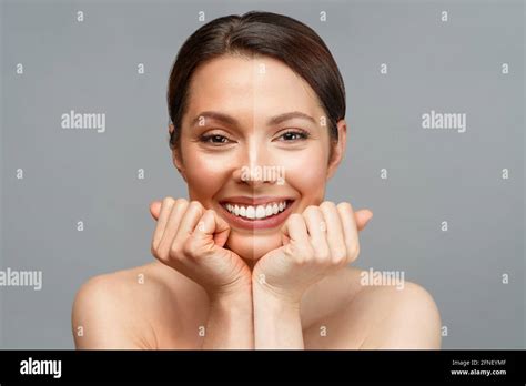 Skin Bleaching Before After Hi Res Stock Photography And Images Alamy