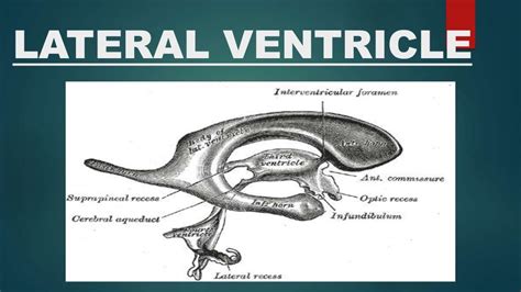 Lateral Ventricle