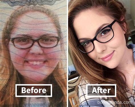 50 Amazing Before And After Pics Reveal How Weight Loss Affects Your Face Health Upward