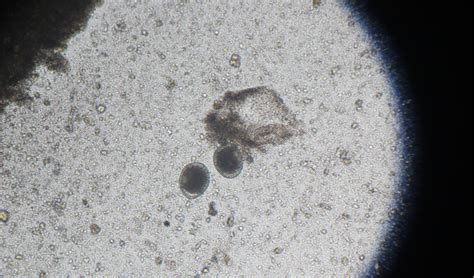 Coccidia go through a complex life cycle in the intestinal cells of goats. Coccidia in Cats | PetCoach