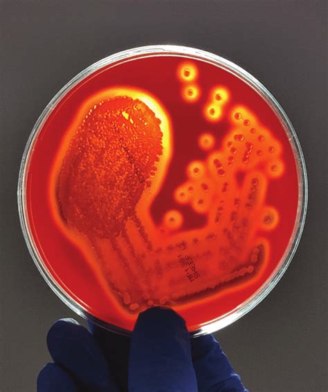 Staphylococcus Aureus Hemolysis On Blood Agar